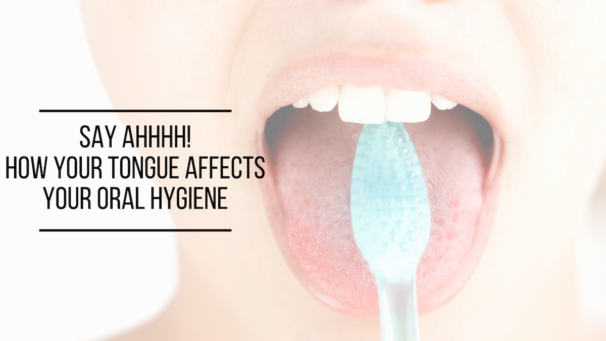 Say Ahhhh How Your Tongue Affects Your Oral Hygiene Dental Associates Of Madison Madison
